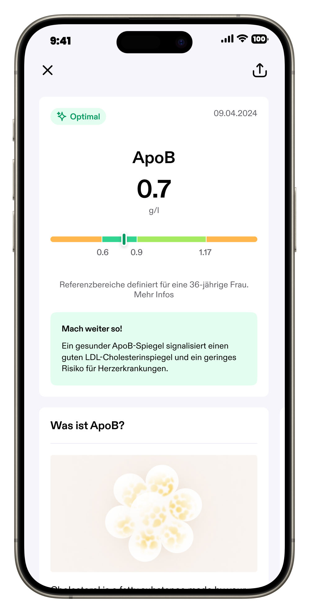 Aware_App Flow_(2) Get your results_(c) Aware